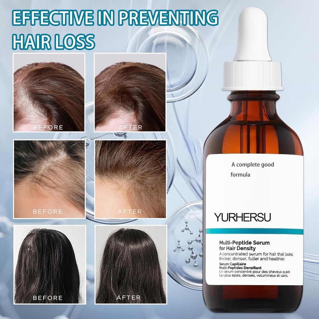 Multi-Peptide Serum for Hair Density 30ml Multi-Peptide Serum for Hair Density Hair Growth Serum for Men and Women For Hair Growth - Additional Image