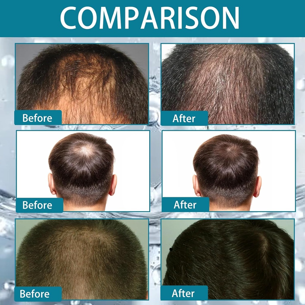 Multi-Peptide Serum for Hair Density 30ml Multi-Peptide Serum for Hair Density Hair Growth Serum for Men and Women For Hair Growth - Additional Image