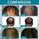 Multi-Peptide Serum for Hair Density 30ml Multi-Peptide Serum for Hair Density Hair Growth Serum for Men and Women For Hair Growth - Additional Image