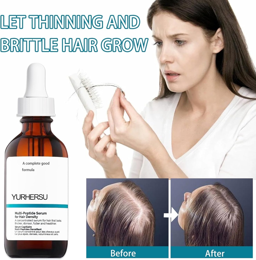 Multi-Peptide Serum for Hair Density 30ml Multi-Peptide Serum for Hair Density Hair Growth Serum for Men and Women For Hair Growth - Additional Image