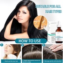 Multi-Peptide Serum for Hair Density 30ml Multi-Peptide Serum for Hair Density Hair Growth Serum for Men and Women For Hair Growth - Additional Image